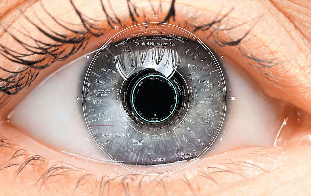 Вт глаз. Иридодиагностика радужной оболочки глаза. Радужки глаз иридодиагностика. Иридодиагностика карие глаза. Иридодиагностика кайма.